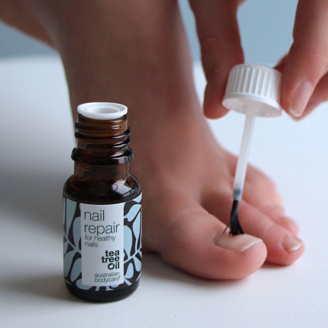 Nagelvård för gula naglar - Två produkter för vård vid nagelsvamp