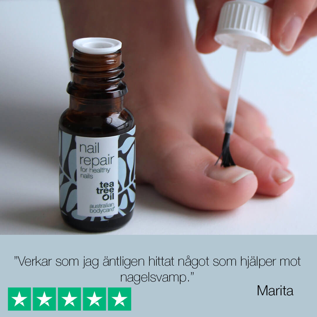 Nagelolja för missfärgade naglar - Nagelvård för missfärgade gula naglar, skivade och grova naglar