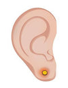 Hur man får bukt ett infekterat hål i örat