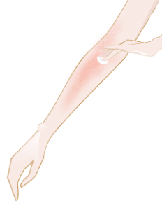 solbranna