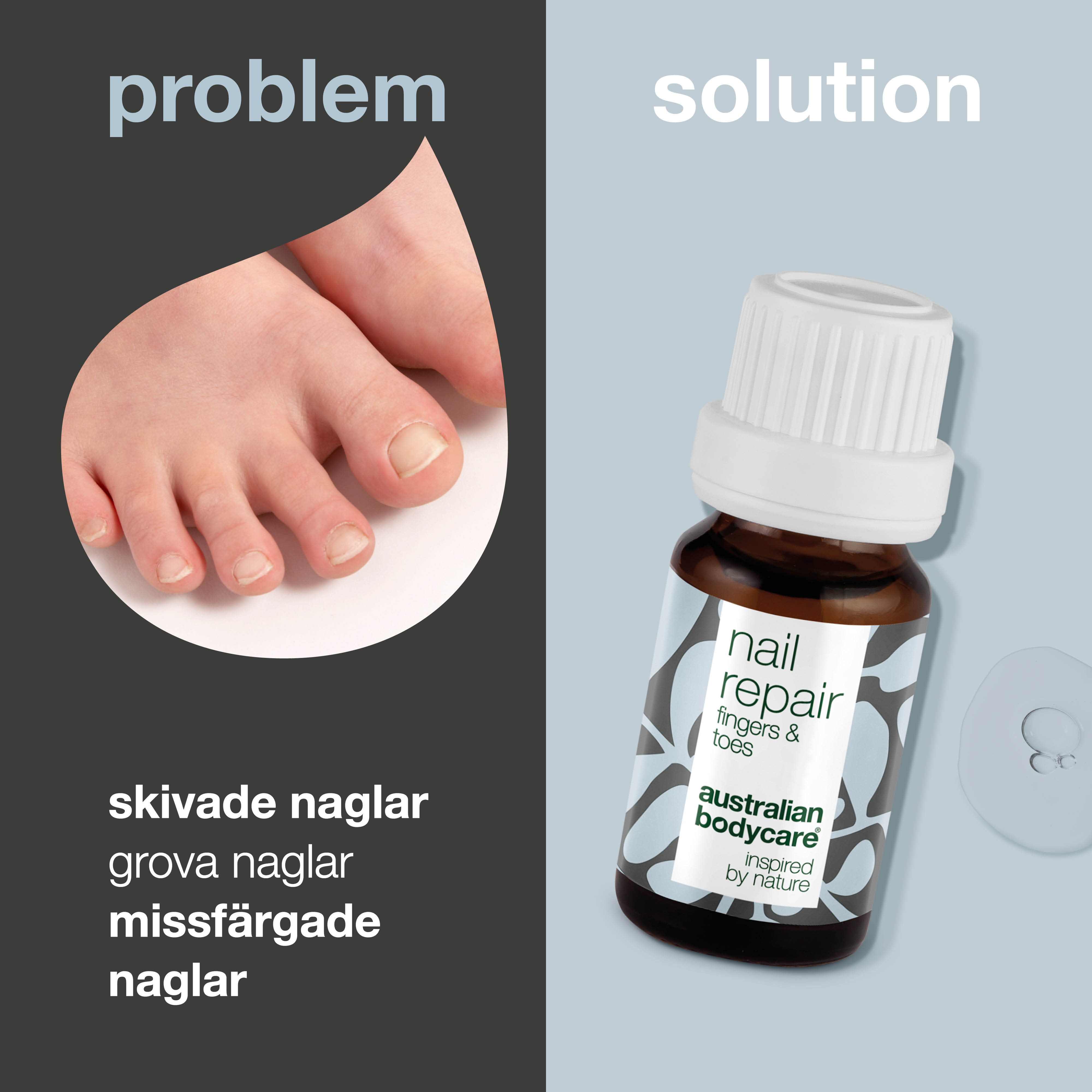 Negleolie til Neglepleje — Neglepleje til misfarvede, revnede og ru negle