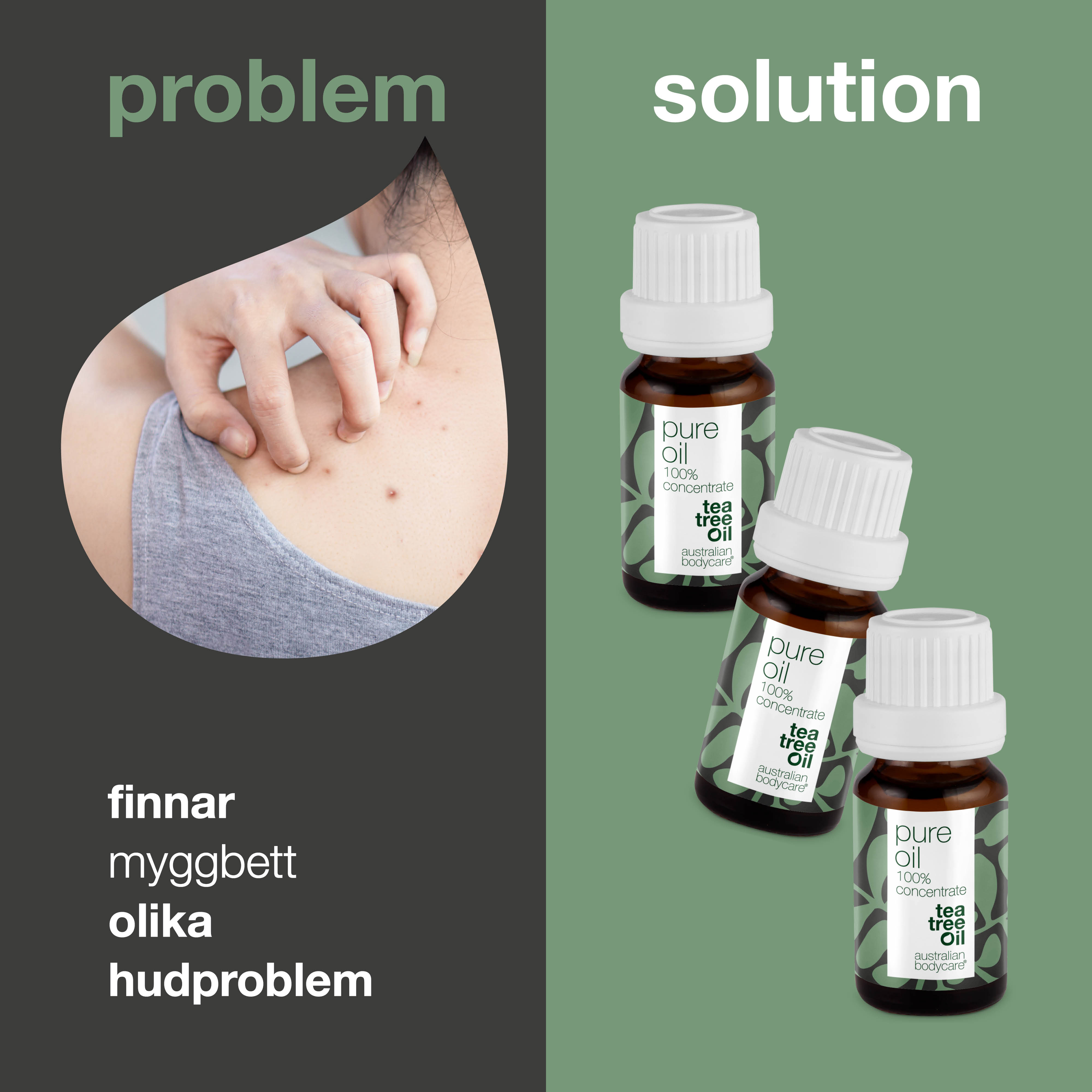 3 stk. XL 30 ml Tea Tree Oil til hudproblemer — 3-pak med 100% koncentreret og ufortyndet Tea Tree Oil fra Australien