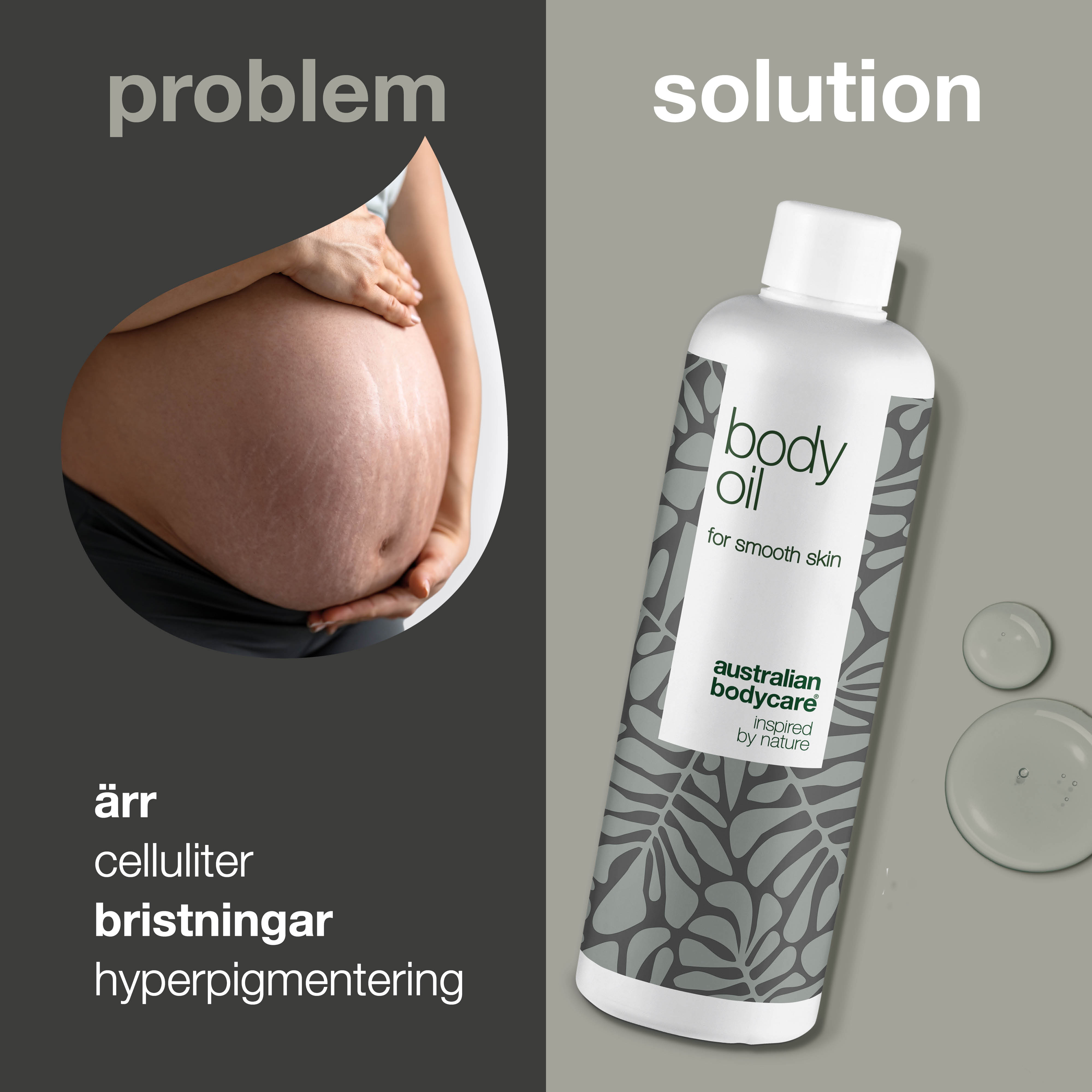 Body Oil – Minskar bristningar, ärr och pigmentfläckar — Body Oil minskar bristningar, ärr och pigmentfläckar. Med mandelolja, squalane och vitamin E återfuktas och mjukgörs huden.