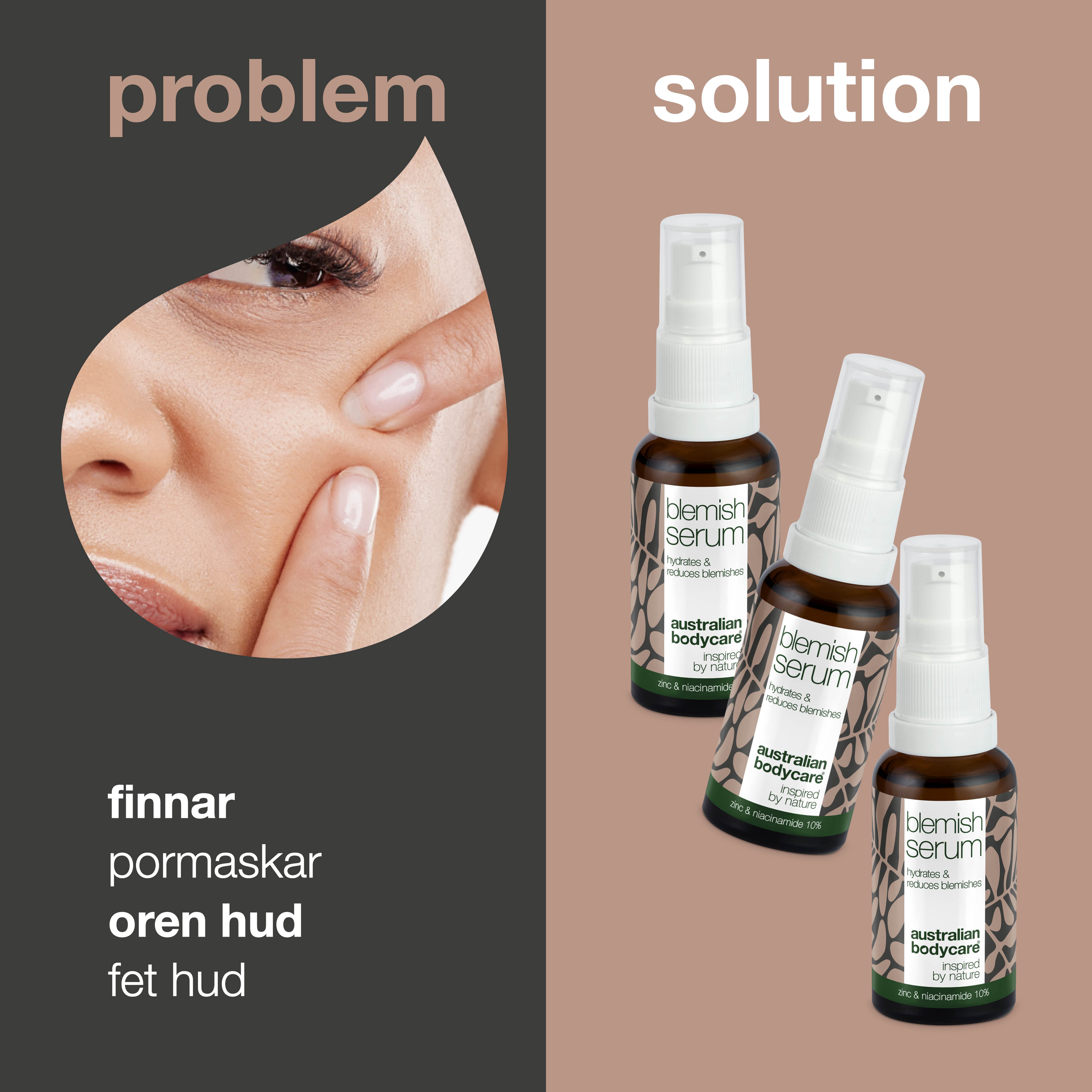 3 stk. Niacinamid Serum til bumser og uren hud — Med Niacinamid 10%, Zink 1% og Tea Tree Oil til uren & fedtet hud