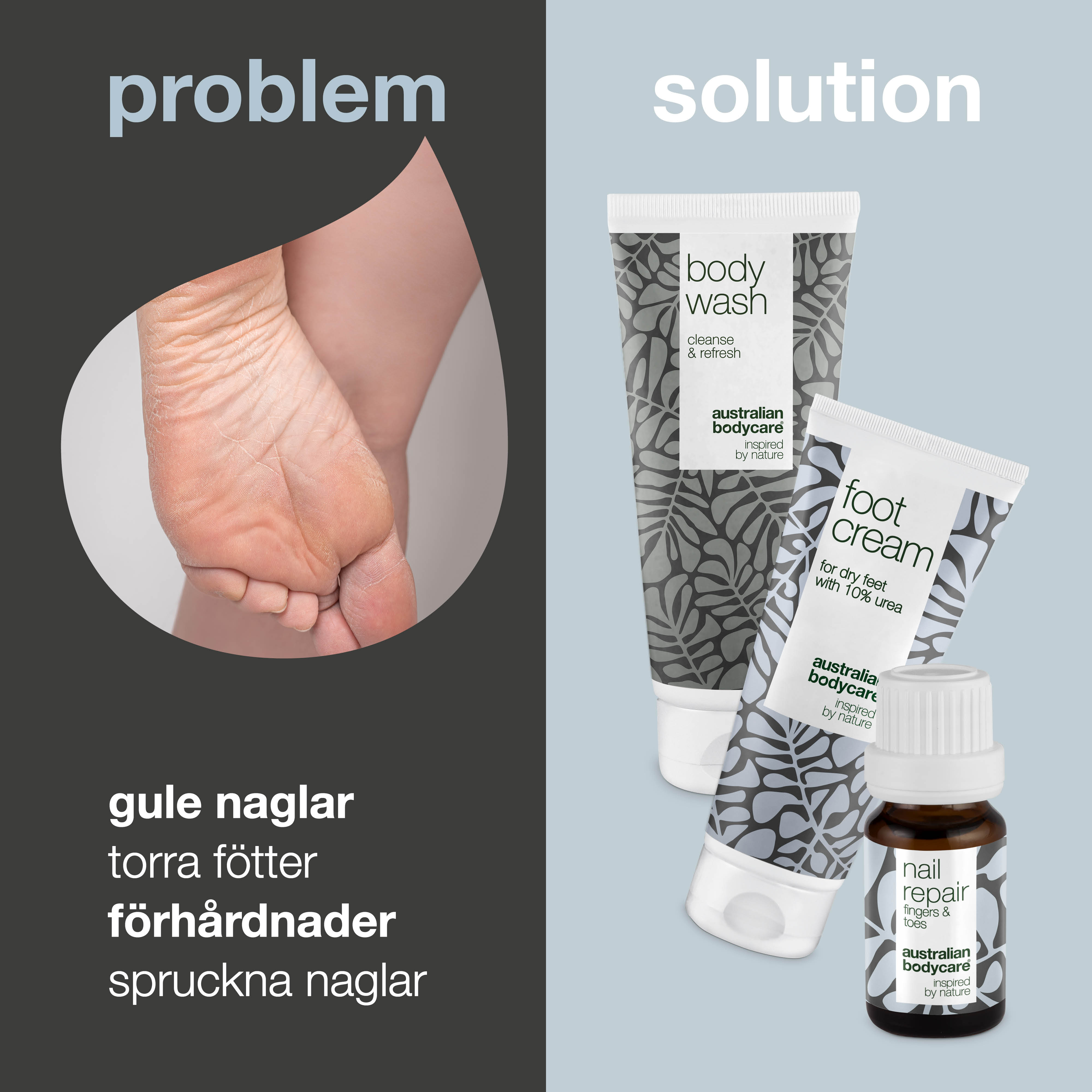 Fodplejepakke — 3 produkter til daglig pleje af tørre fødder og gule negle