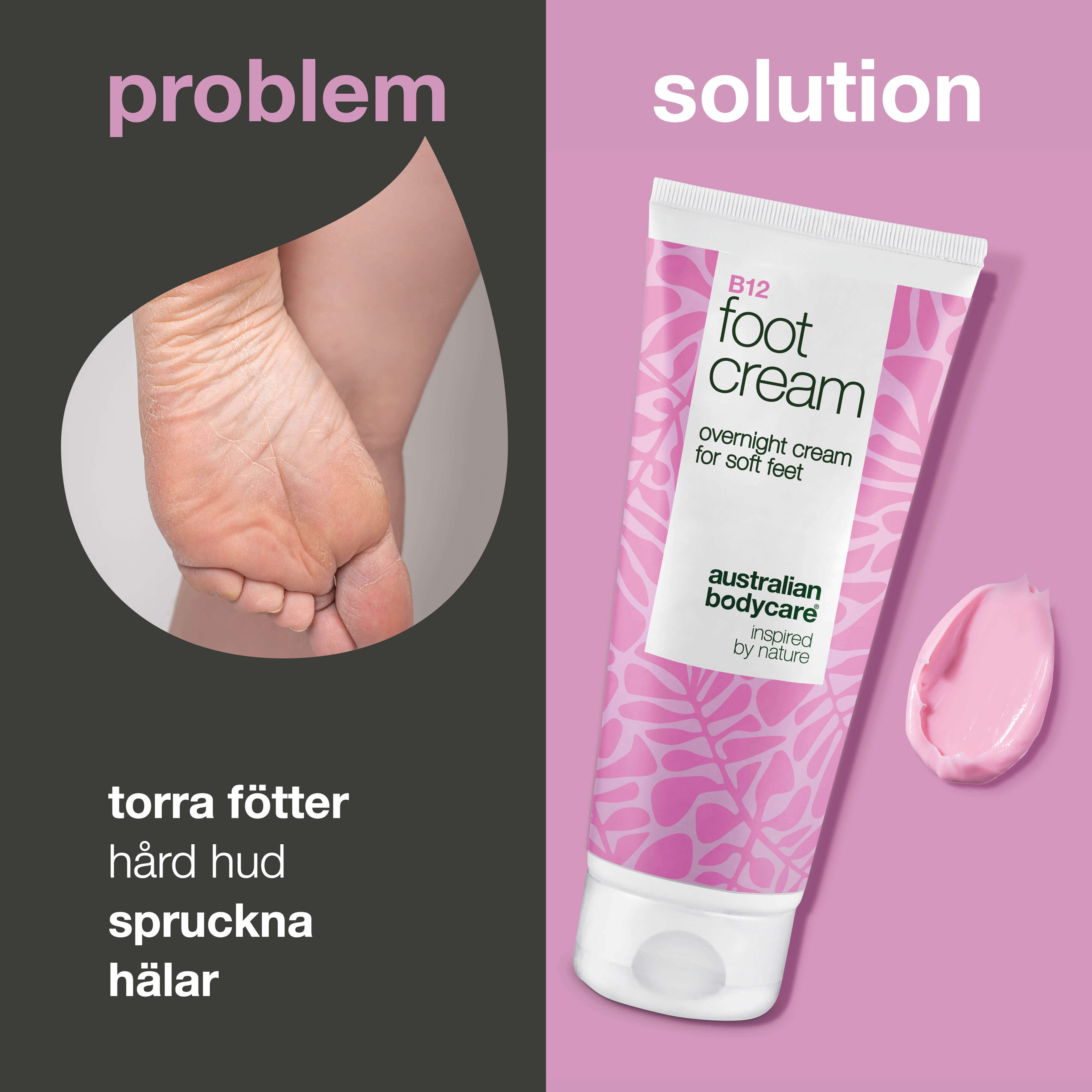 Fotkräm med B12-vitamin – återfuktar och mjukgör — Fotkräm med B12-vitamin och 10 % urea. Återfuktar och mjukgör torr hud. Perfekt som nattkräm eller efter ett fotbad.