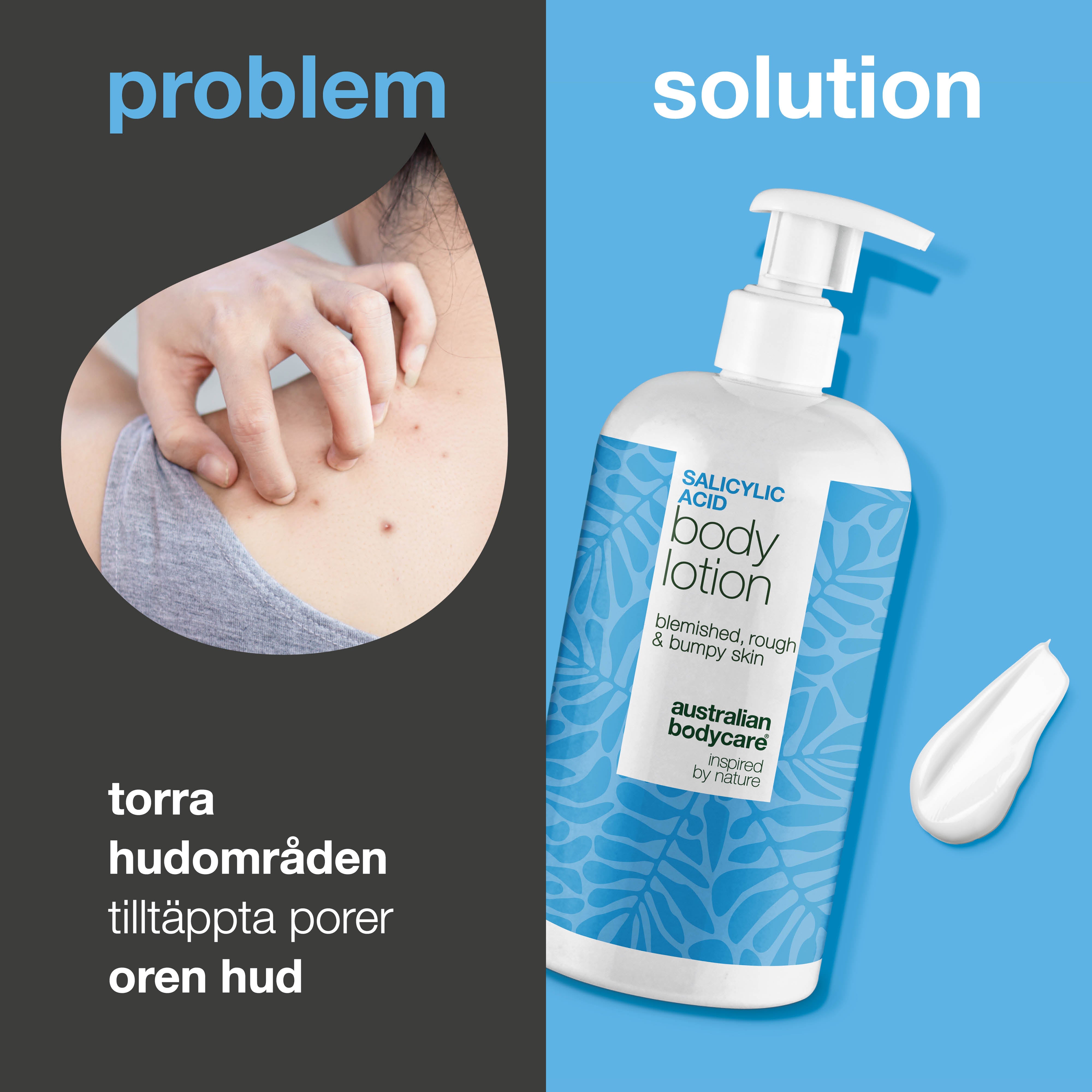 Body Lotion med salicylsyra – för torr och ojämn hud — Body Lotion med salicylsyra exfolierar, återfuktar och hjälper till att mjuka upp torr och ojämn hud. Perfekt för daglig användning.