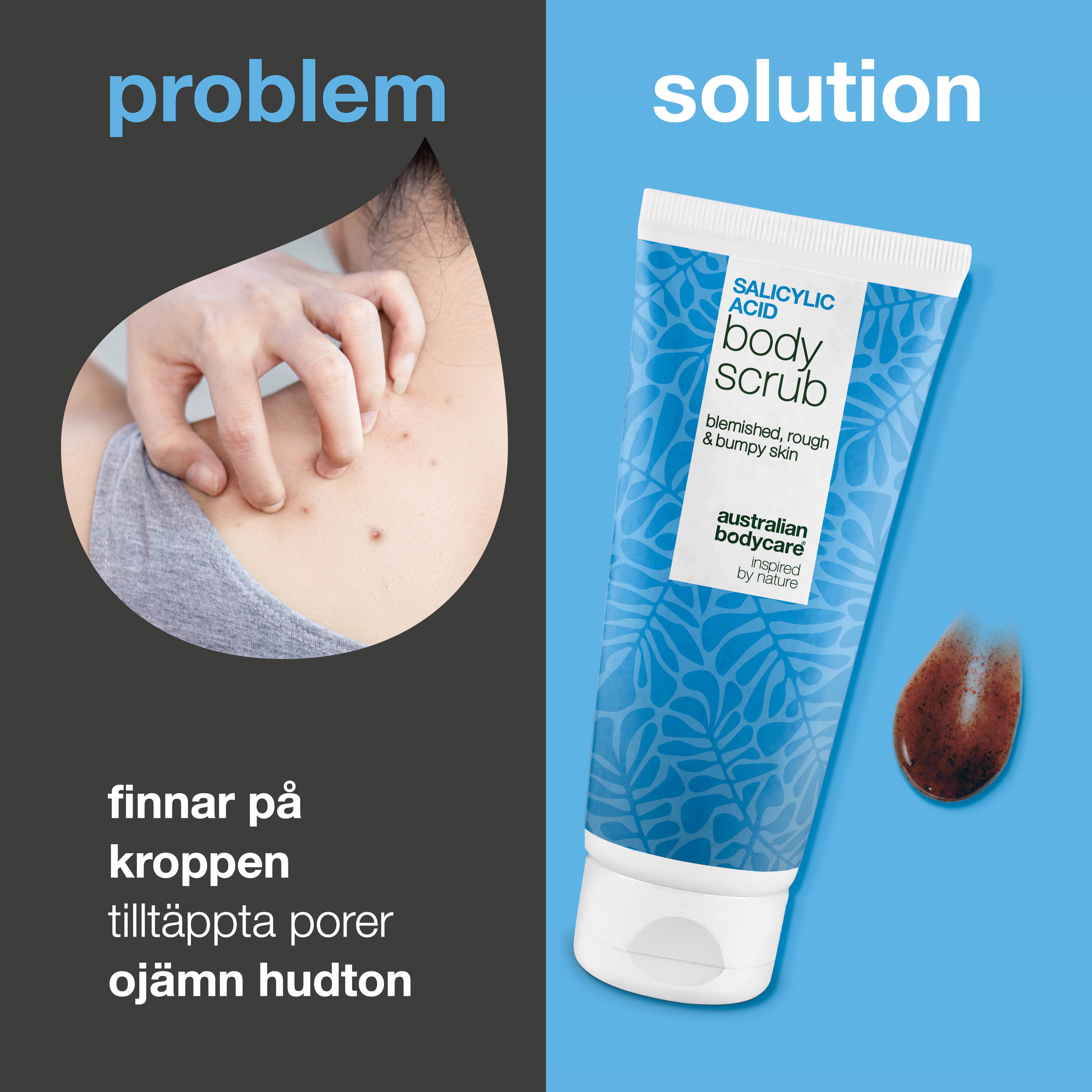 Body Scrub med salicylsyra för oren och ojämn hud på kroppen — Body Scrub med salicylsyra tar bort finnar och orenheter. Innehåller salicylsyra, glykolsyra, aprikoskärnpulver och allantoin.