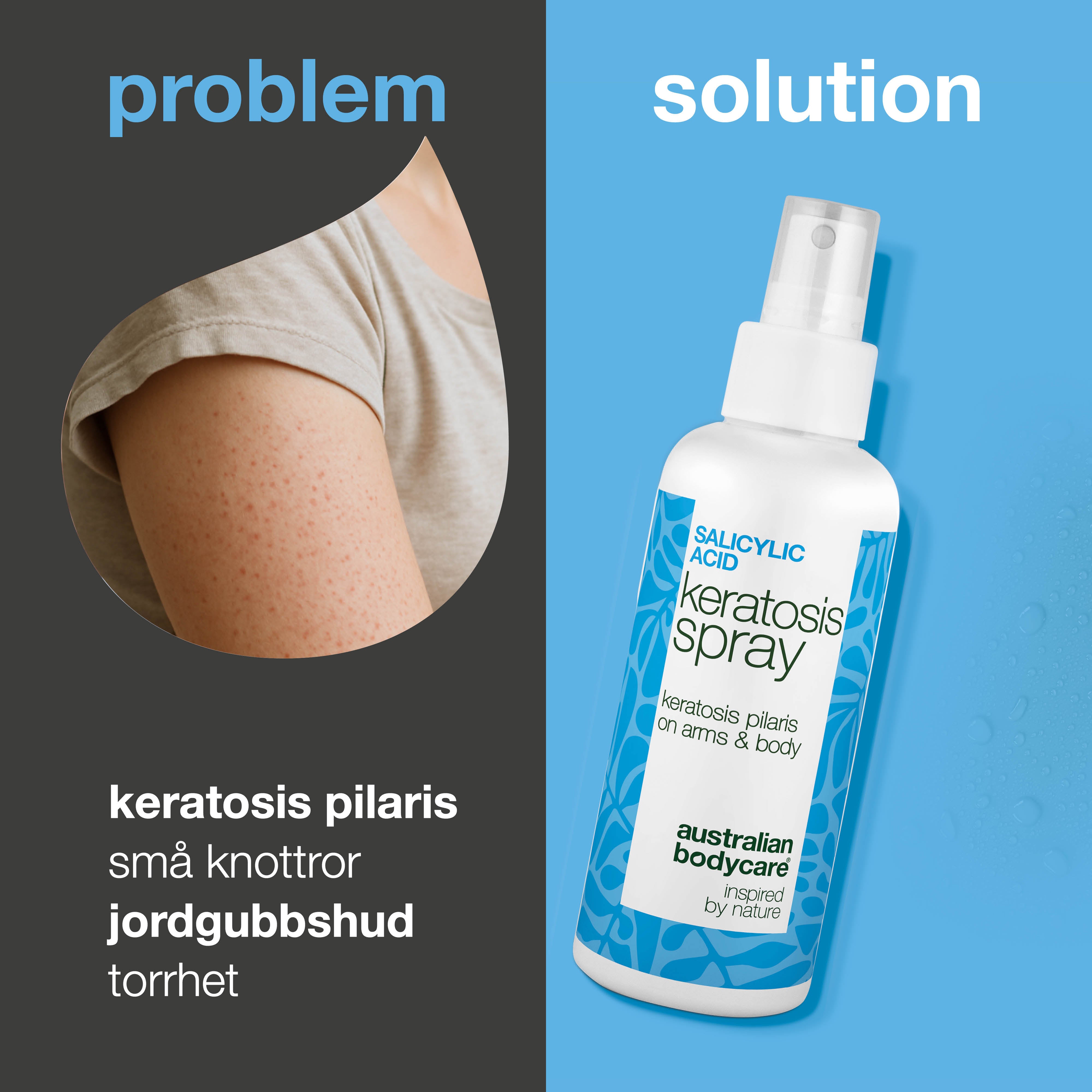 Spray mot keratosis pilaris och knottrig hud på armar och ben — Keratosis pilaris spray jämnar ut knottrig hud. Innehåller salicylsyra som exfolierar och minskar tilltäppta porer.