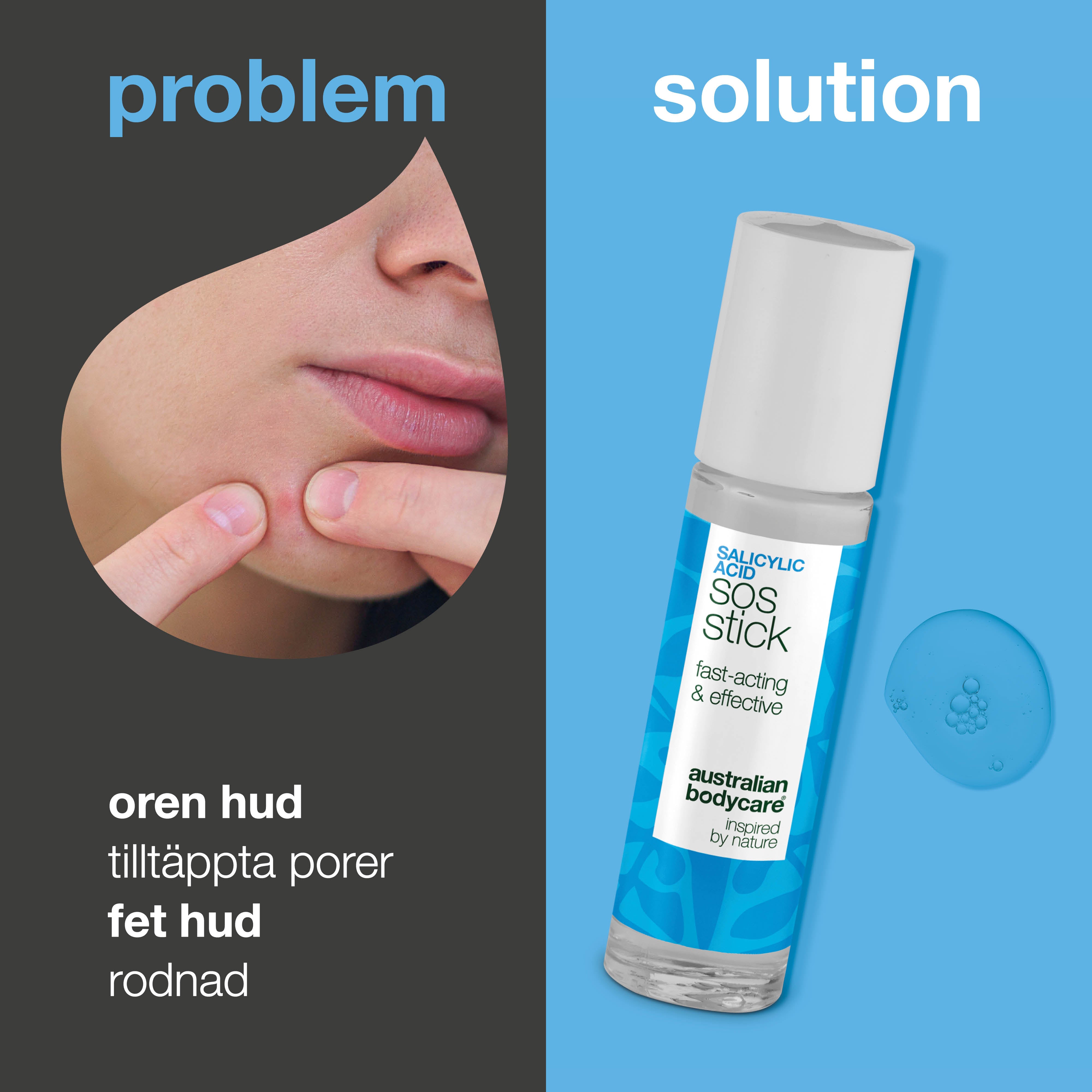 Salicylsyra SOS Stick mot finnar och rodnad – minskar tilltäppta porer och lugnar huden