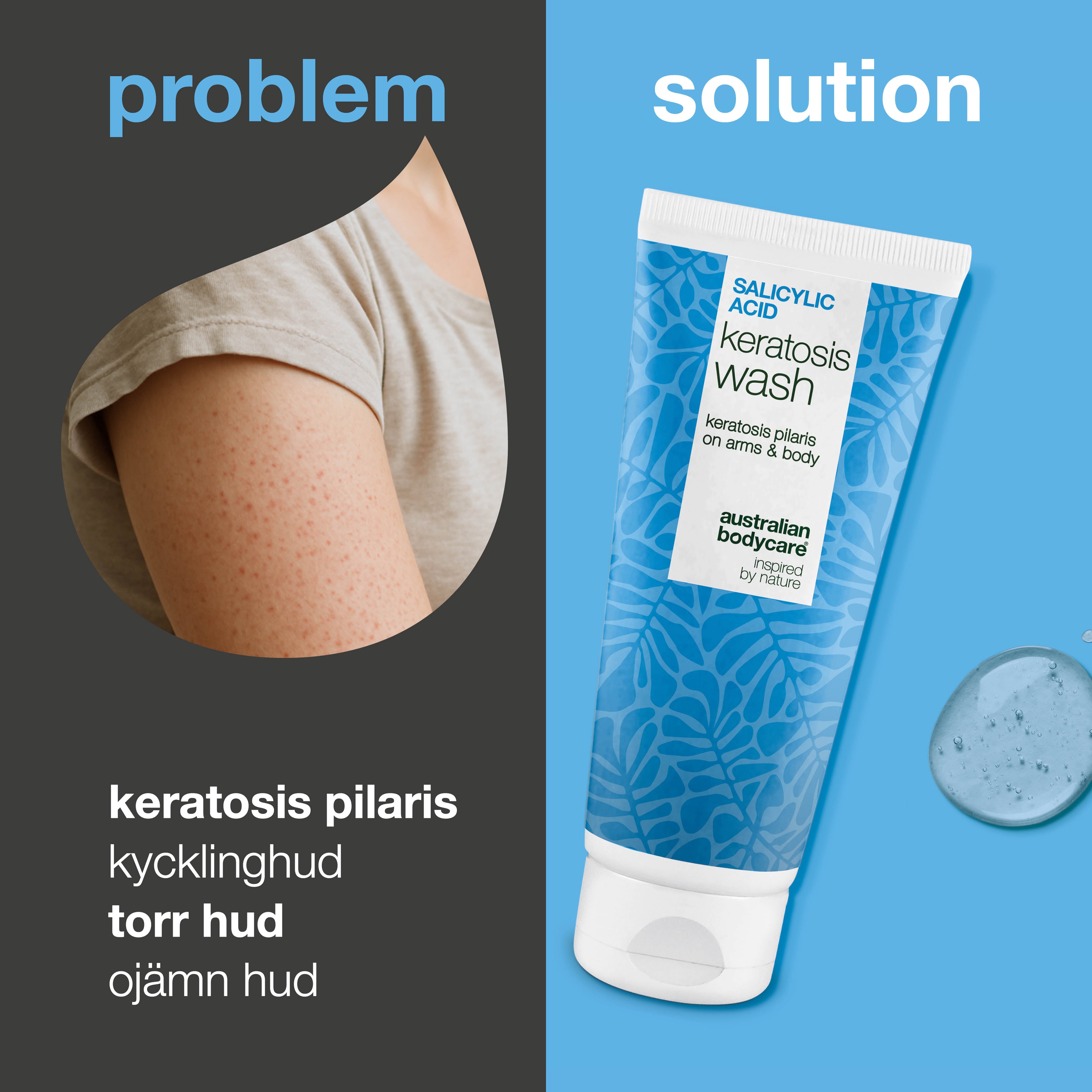 Keratosis Pilaris Body Wash mot keratosis pilaris, röda knottror och porer. Innehåller salicylsyra, niacinamid, zink PCA och vitamin E för slätare hud.