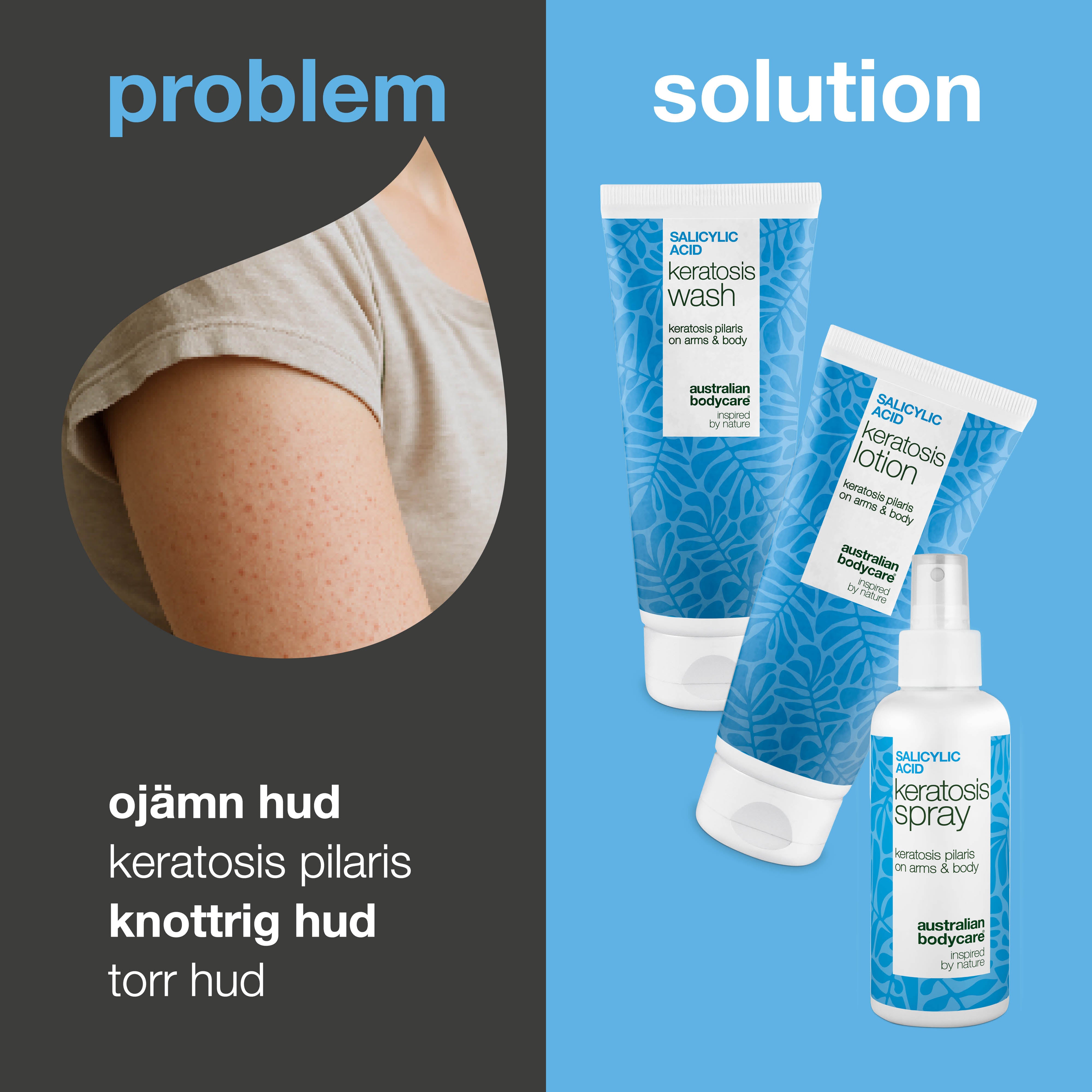Paket mot Keratosis Pilaris – Jämnar ut knottrig hud — Paket mot Keratosis Pilaris gör torr och knottrig hud mjuk och slät. Perfekt för jordgubbshud och gåshud på armar, lår och kropp.