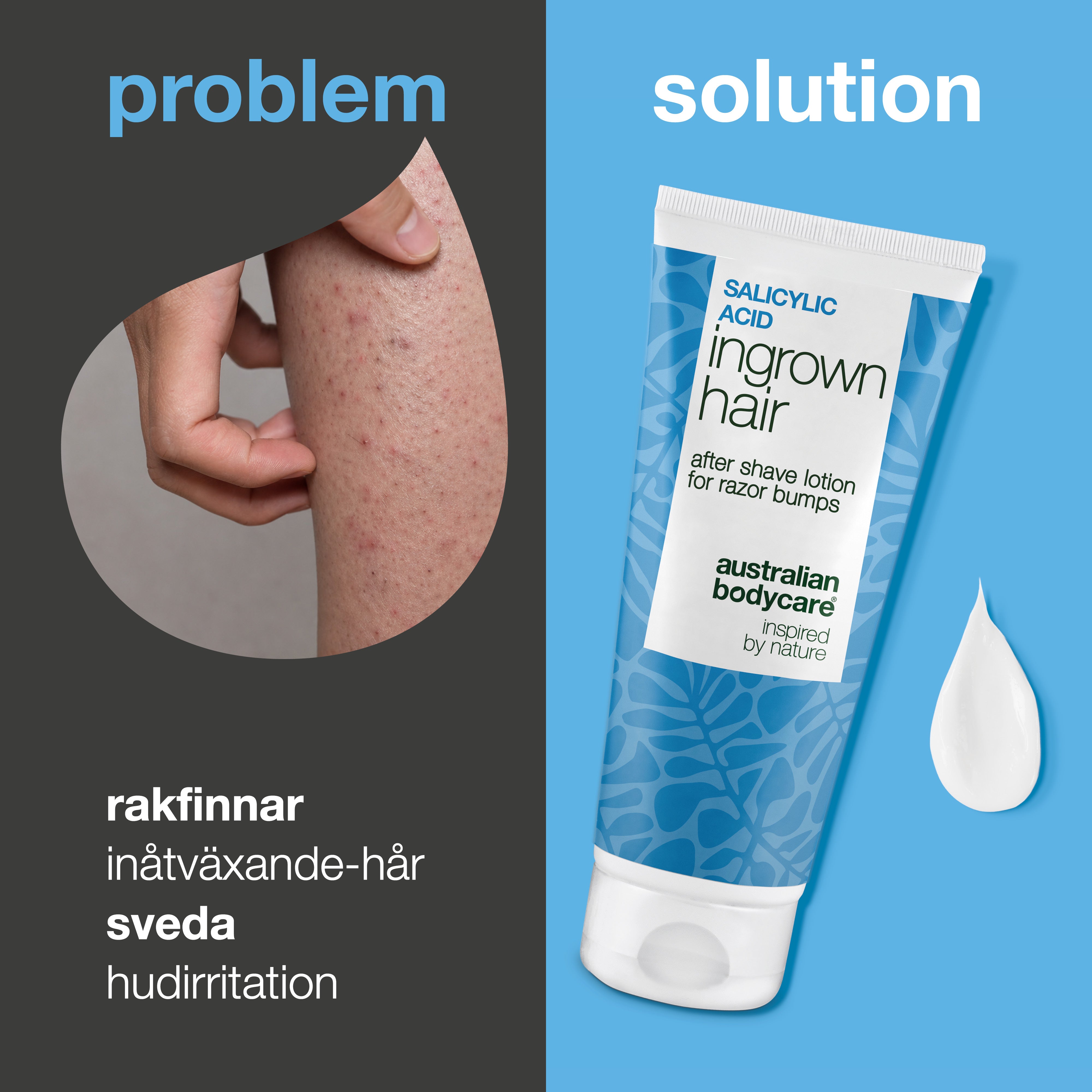 Salicylsyra After Shave Lotion mot inåtväxta hårstrån, röda prickar och rakningsirritation. Produkten visas bredvid hud med synliga röda prickar och inåtväxta hårstrån.