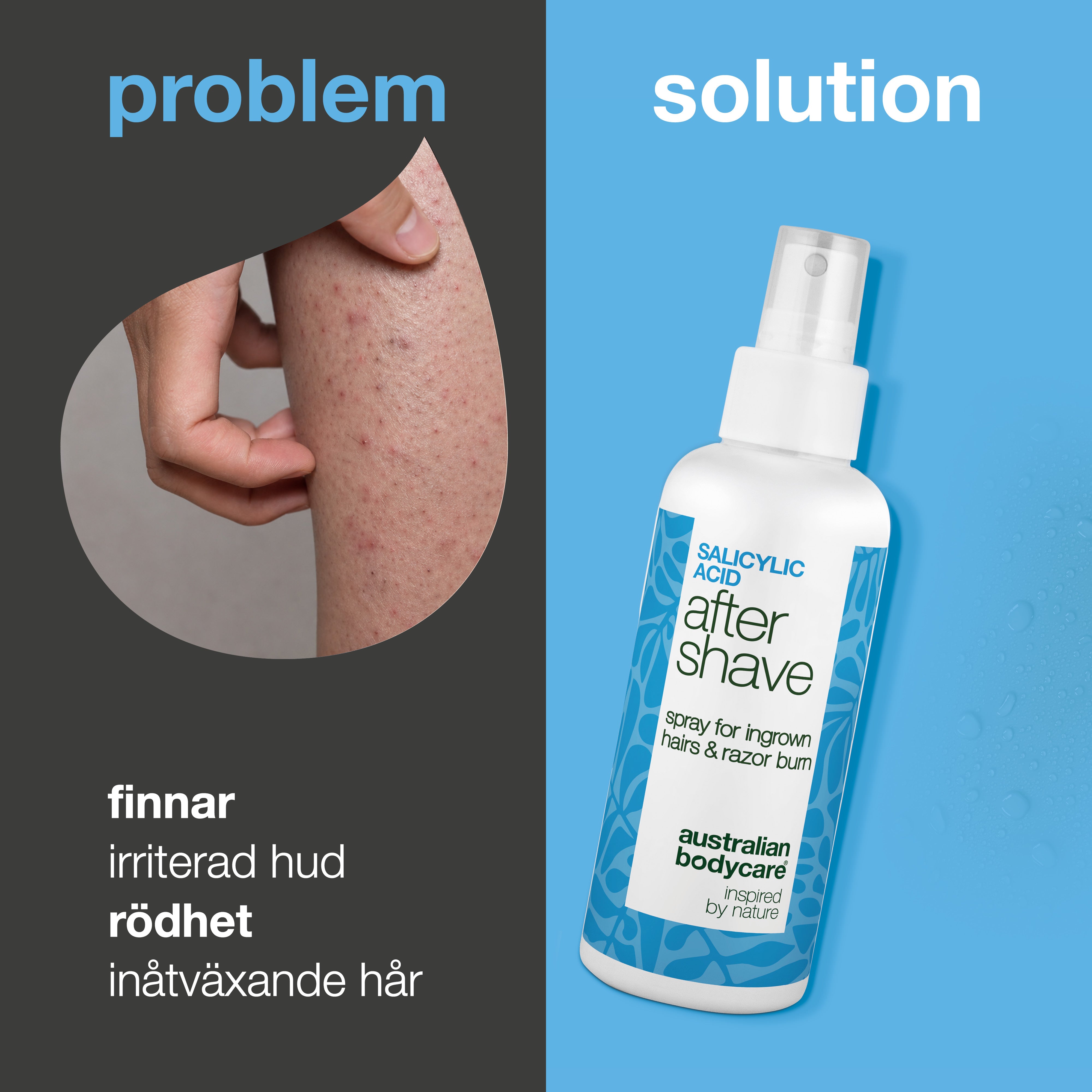 Salicylsyra After Shave Spray mot röda prickar — After Shave Spray mot inåtväxta hår och röda prickar. Lugnar klåda med salicylsyra och Aloe Vera för ett slätt resultat. Prova den nu!
