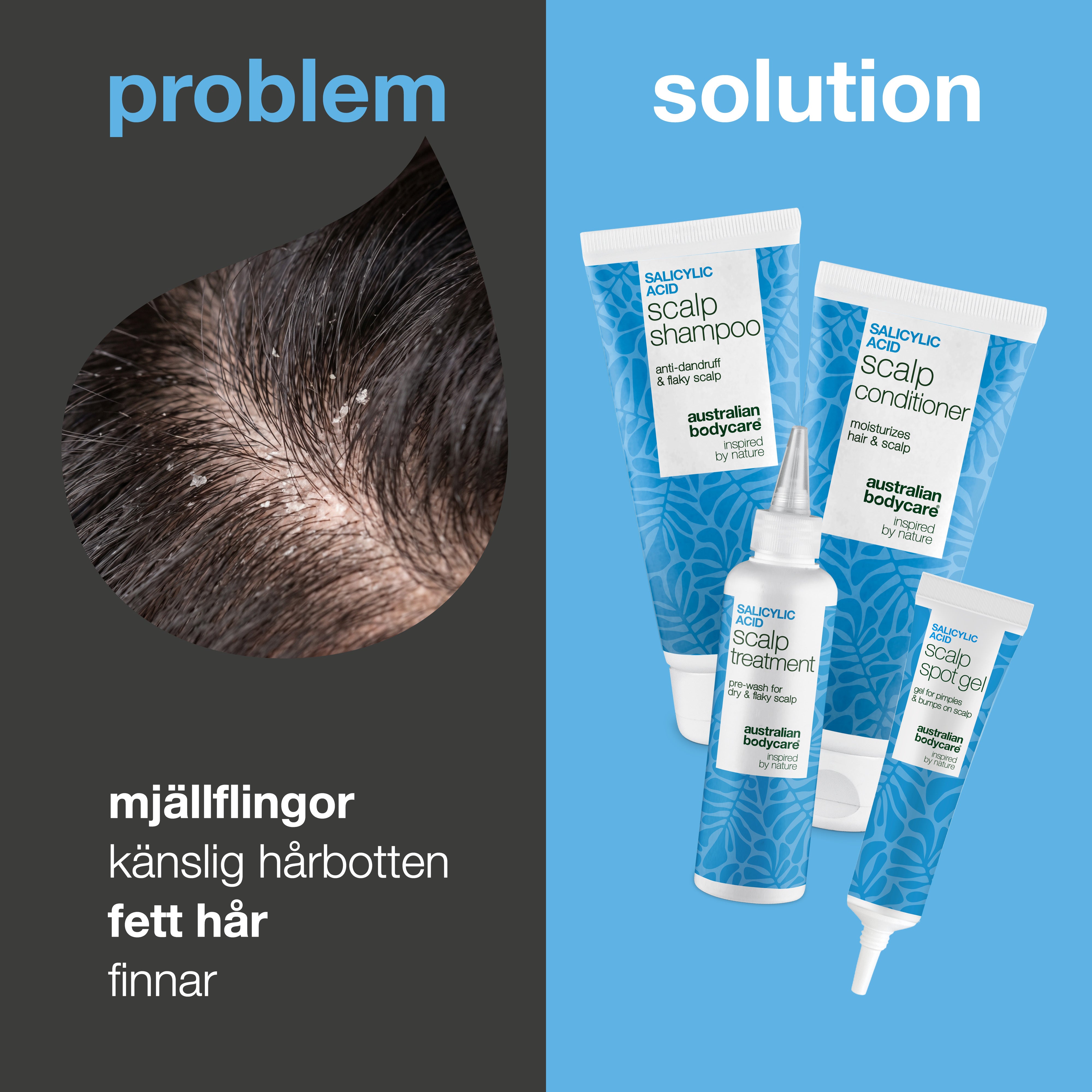 Problem och lösning: närbild på mjäll i hårbotten bredvid de fyra produkterna mot klåda, mjäll och finnar