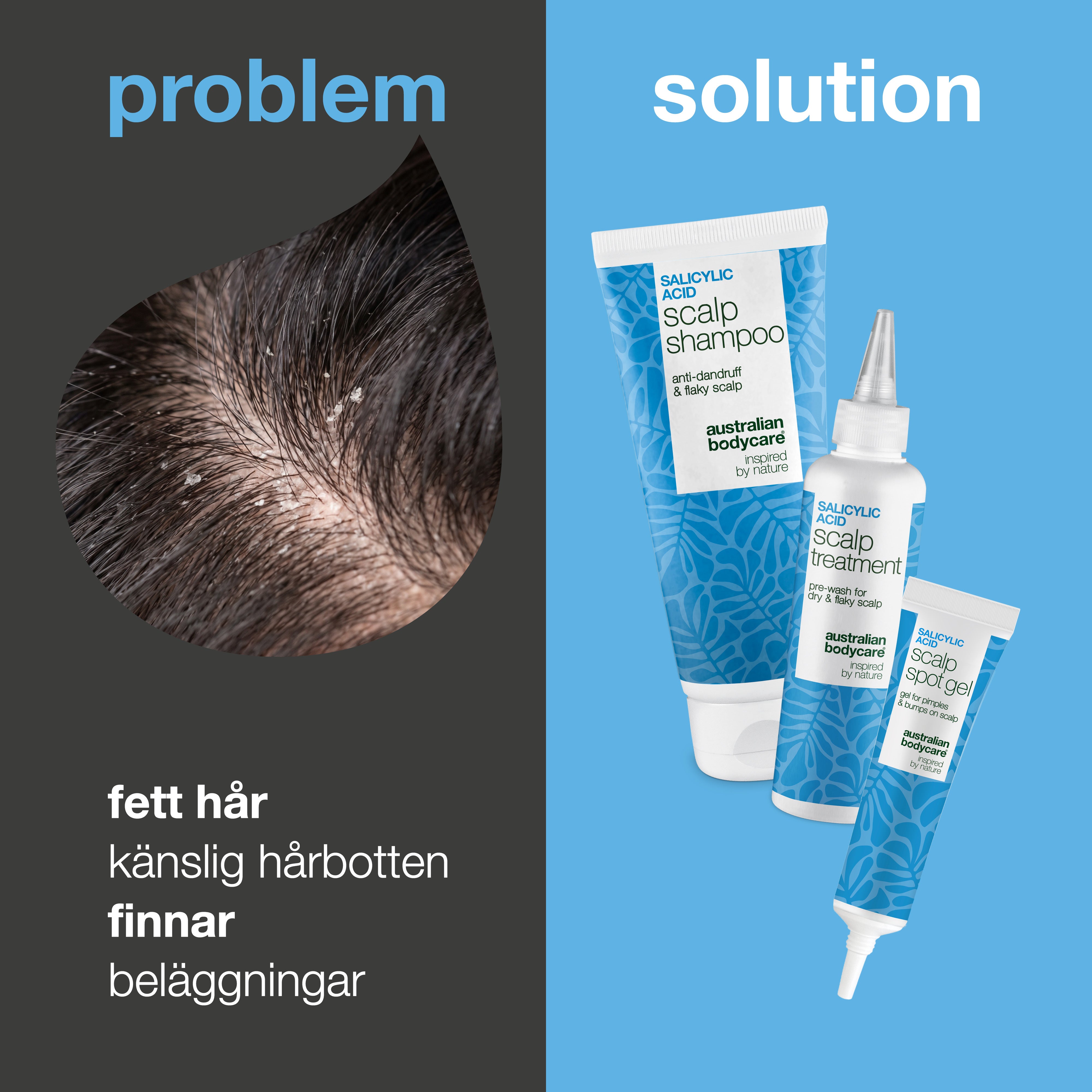 Problem och lösning: närbild på klåda, fett hår och beläggningar i hårbotten bredvid paketets tre produkter
