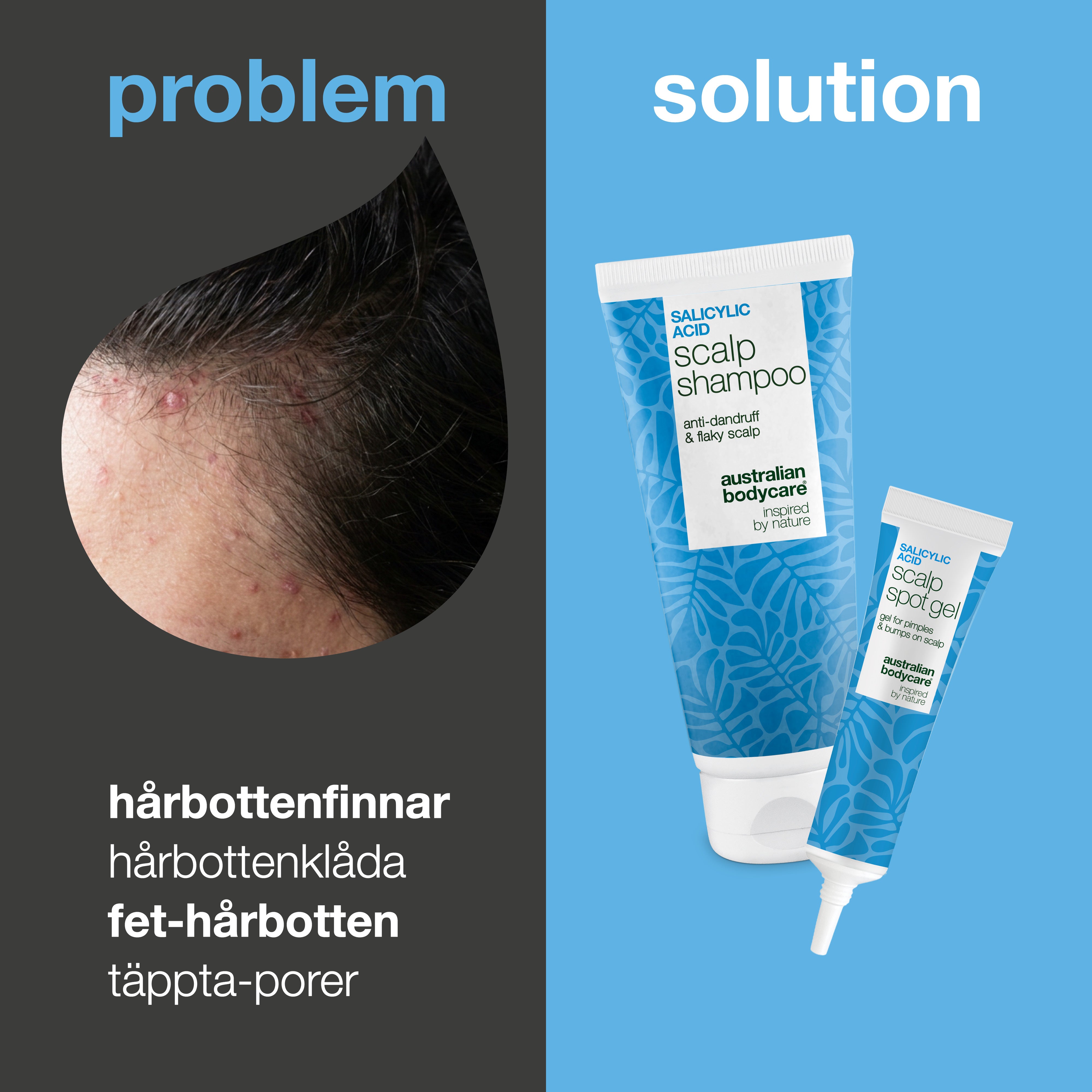 Problem och lösning: närbild på finnar och knottror i hårbotten bredvid paketets schampo och spot gel
