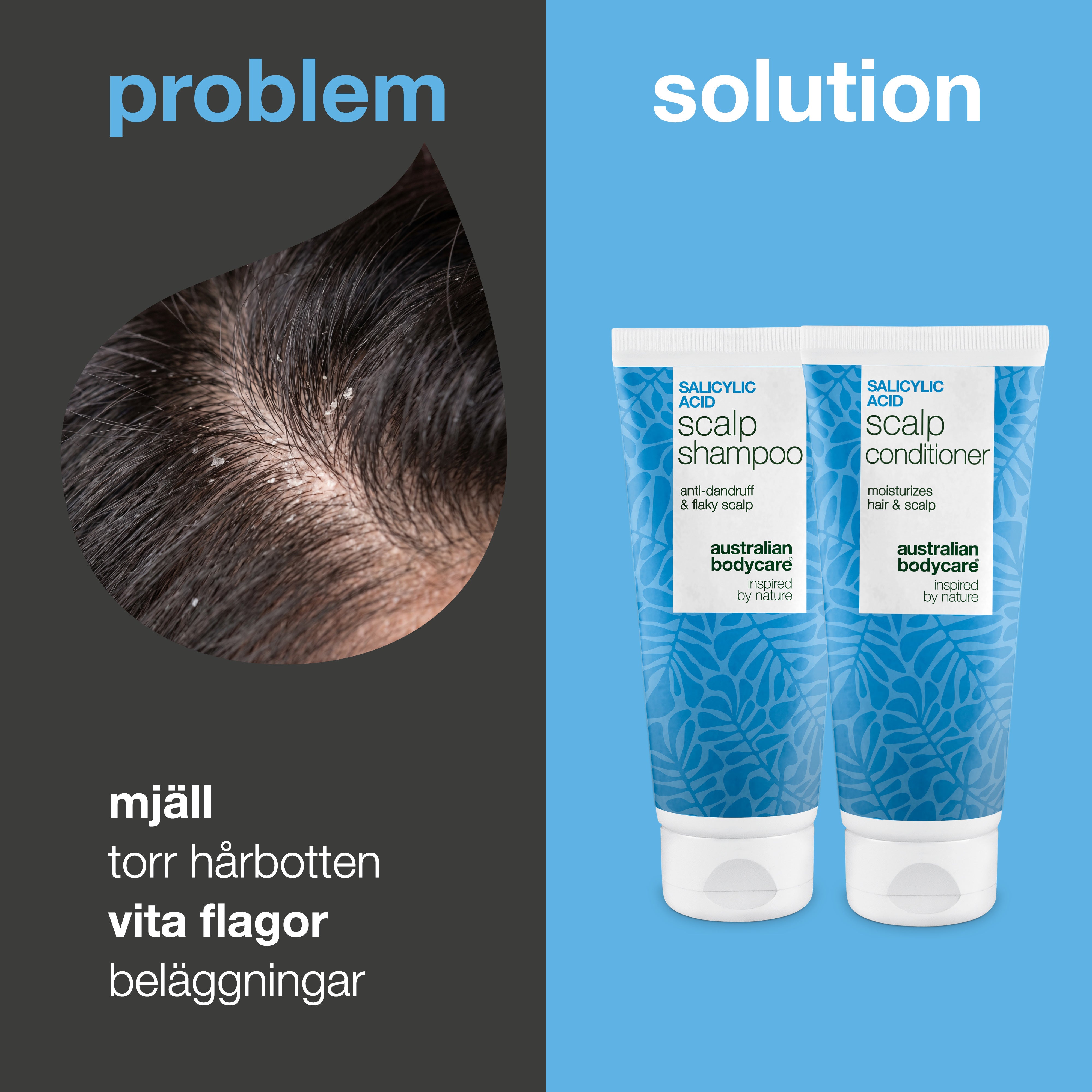 Problem och lösning: närbild på mjäll och vita flagor i hårbotten bredvid paketets schampo och balsam