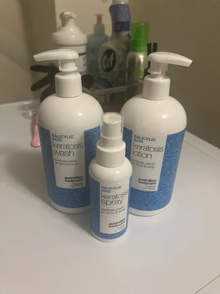 Kundresultat keratosis pilaris – Isabell C.