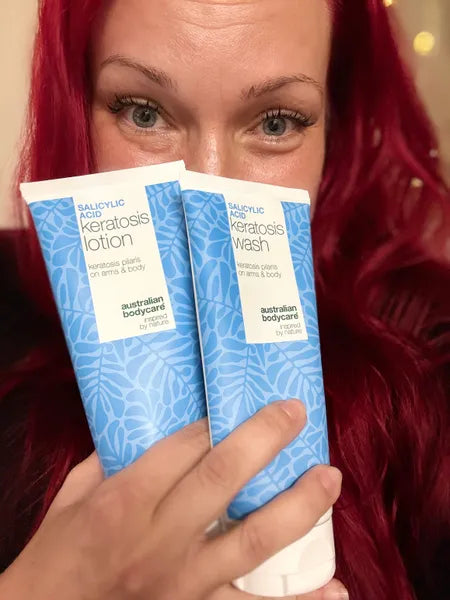 Kundresultat keratosis pilaris – Viktorija K.