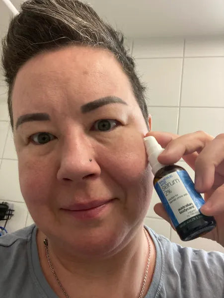 Kundresultat finnar i ansiktet – Anne K.